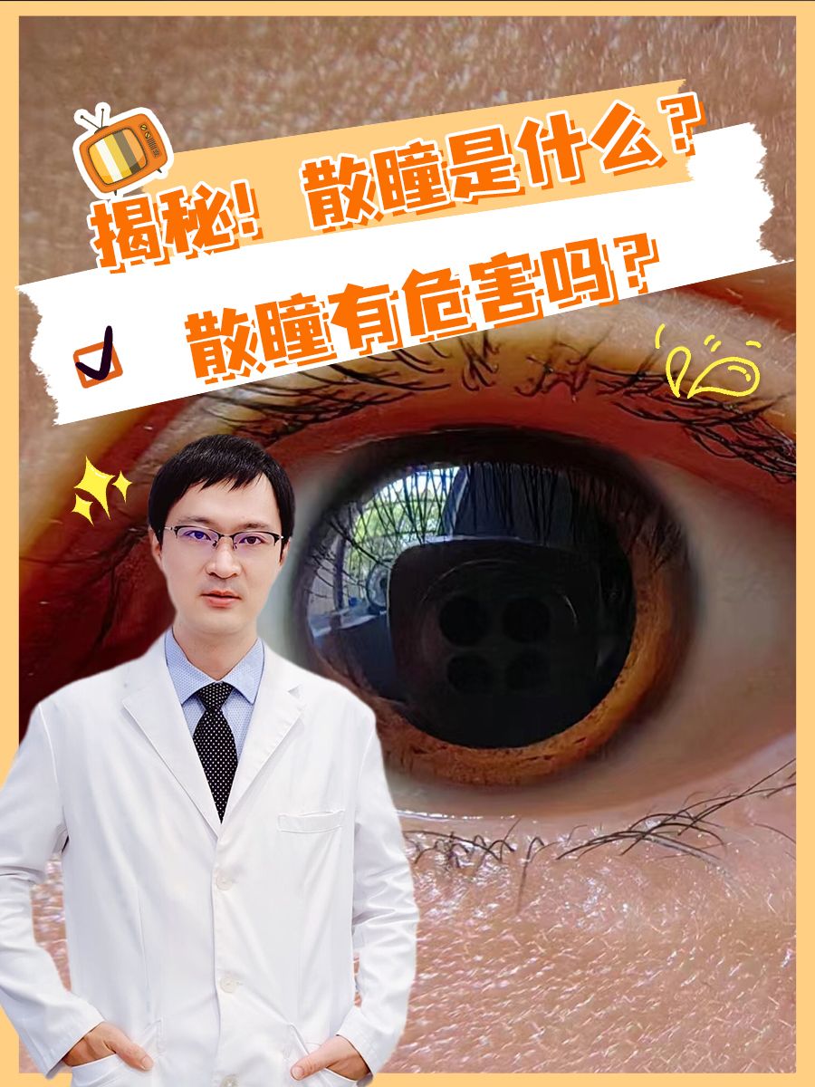 揭秘!散瞳是什么?散瞳有危害吗?