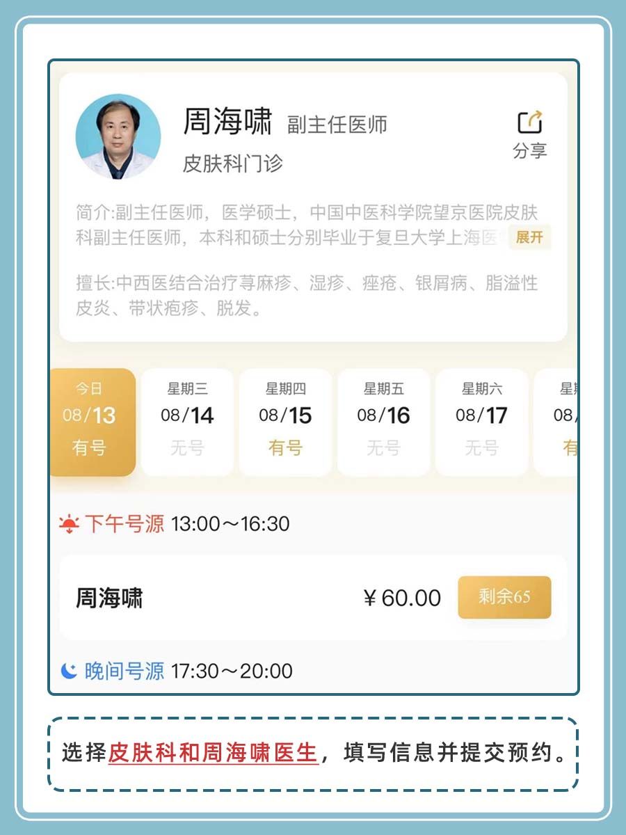 北京望京医院周海啸医生怎么样？怎么挂号？