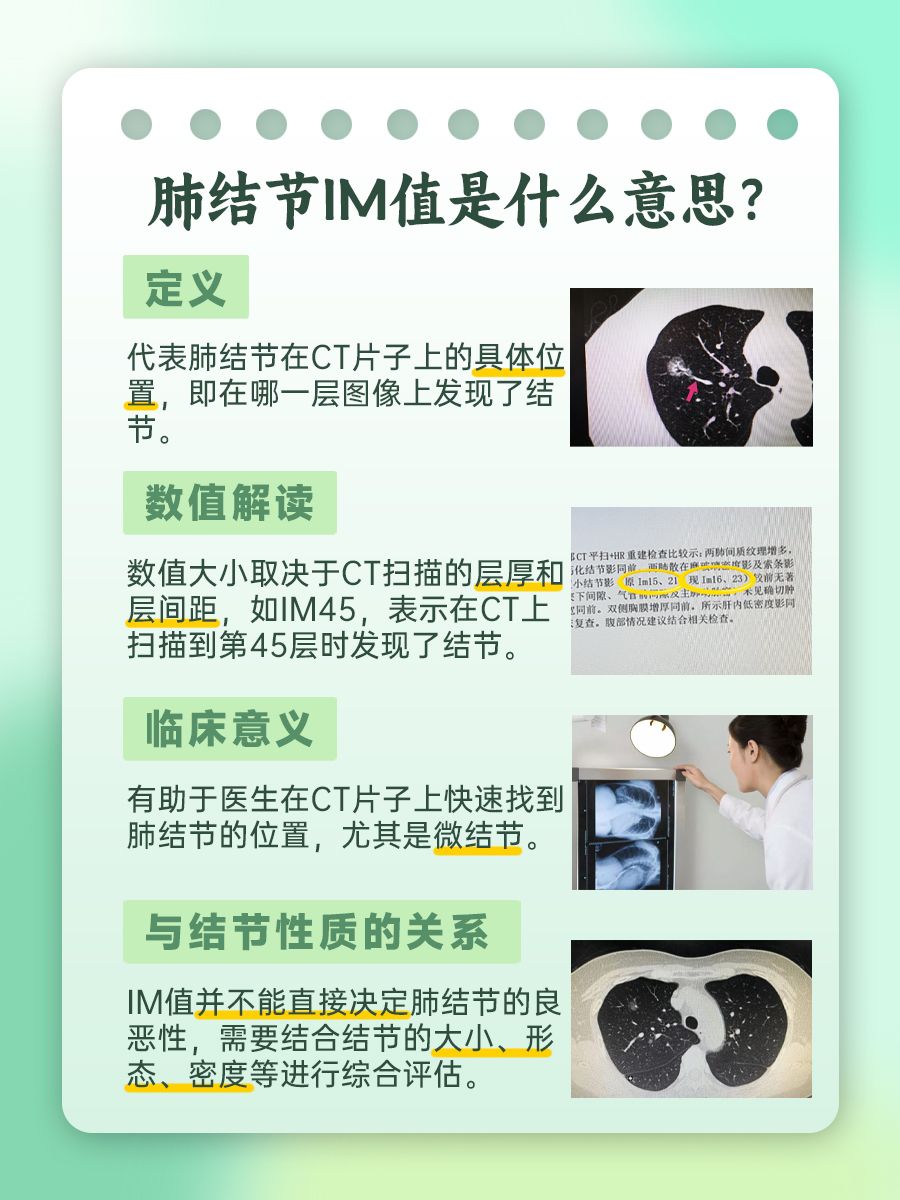 肺结节IM值大好还是小好？了解一下！