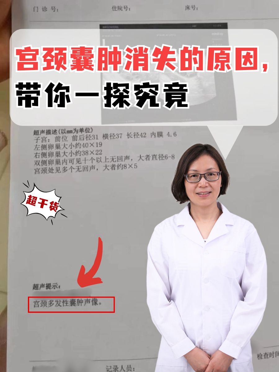 宫颈囊肿消失的原因，带你一探究竟