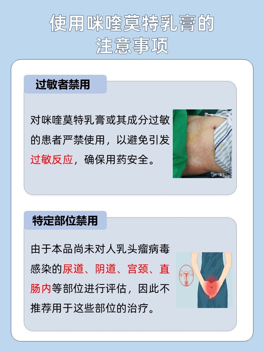 咪喹莫特乳膏功效与作用解析：疣体的强劲对手！