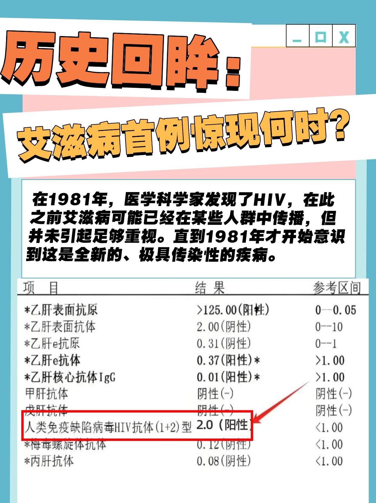 历史回眸：艾滋病首例惊现何时？