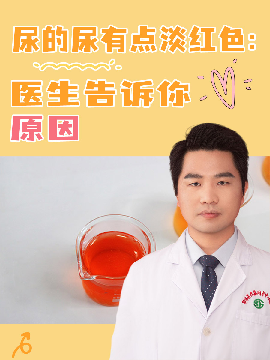 尿的尿有点淡红色：医生告诉你原因