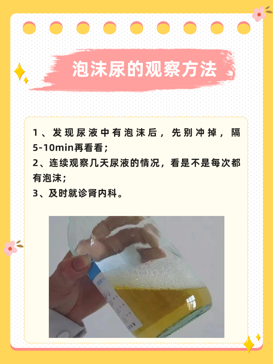 教你分辨泡沫尿，不再为此惶恐