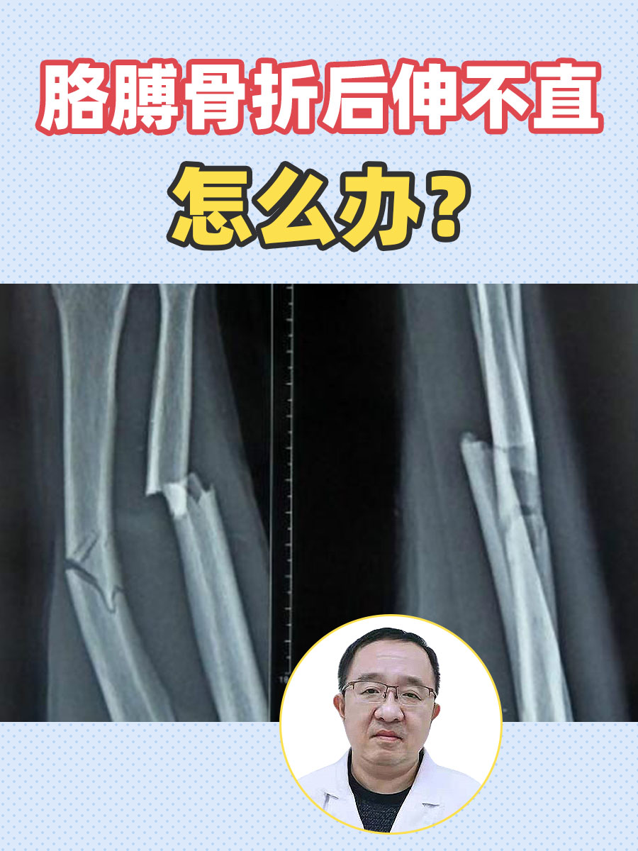 胳膊骨折后伸不直，怎么办？