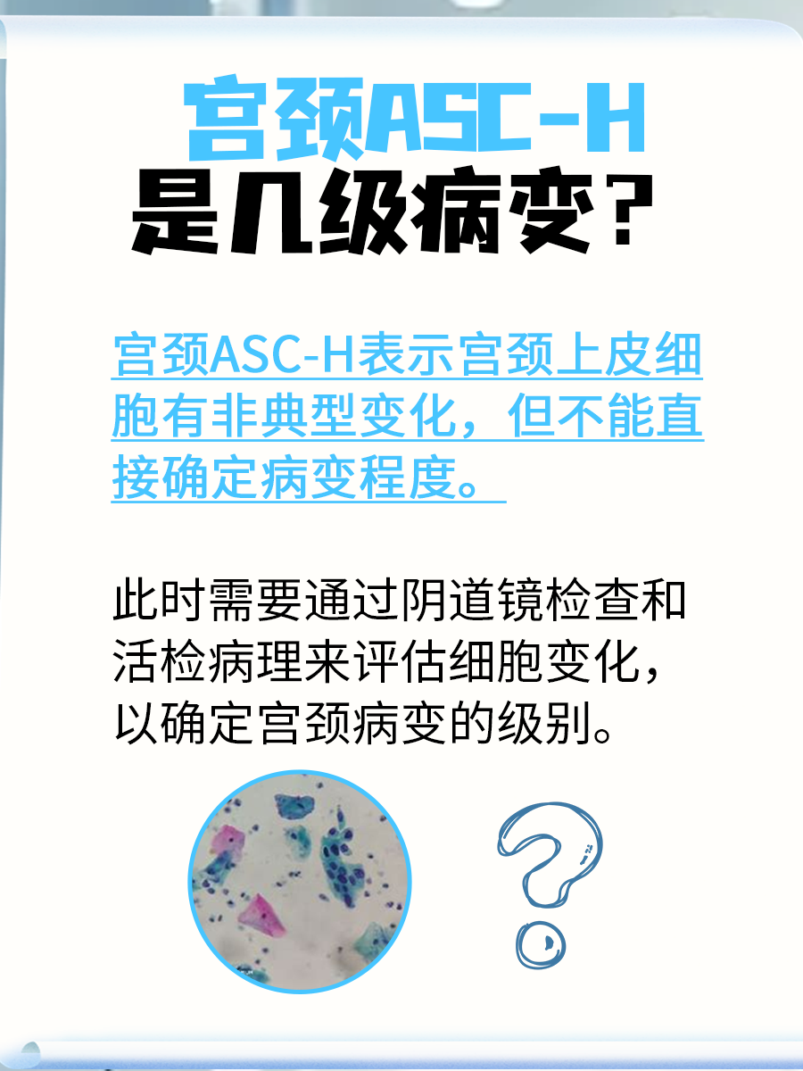 宫颈ASC-H是什么？宫颈病变的风险信号