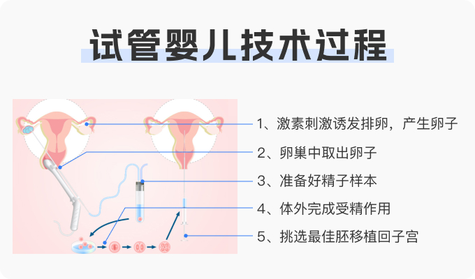 取卵针长什么样正规的辅助生殖也要取卵吗？专业医院这样操作_https://www.jmylbn.com_新闻资讯_第1张