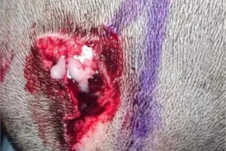 开放性颅脑损伤症状图