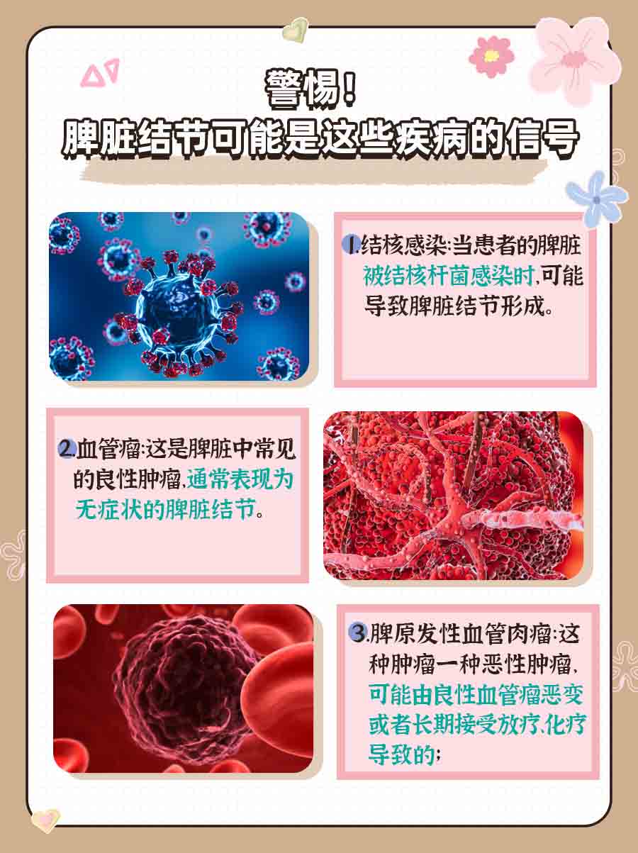 警惕！脾脏结节可能是这些疾病的信号
