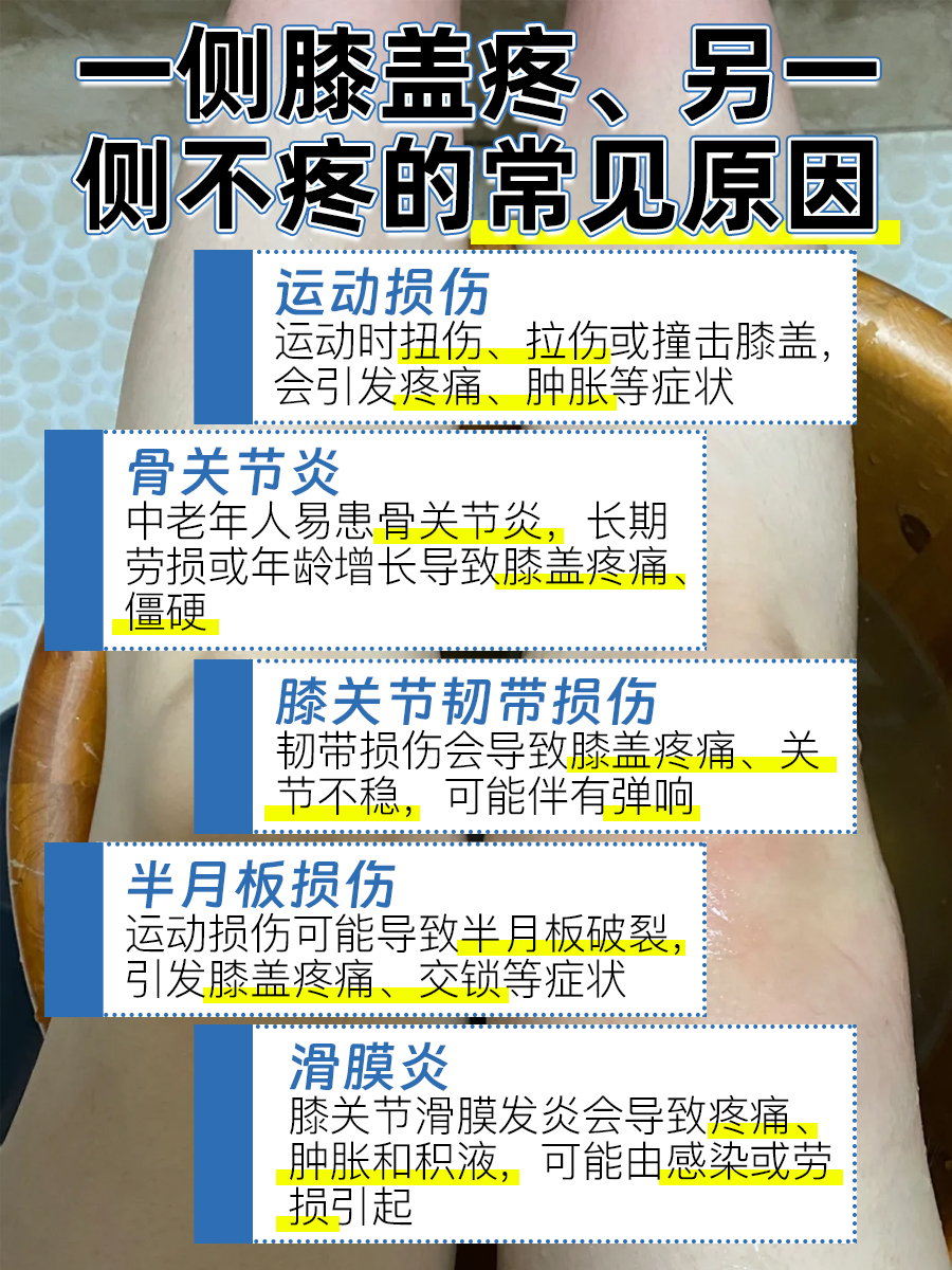 膝盖“偏爱”疼,不容忽视!