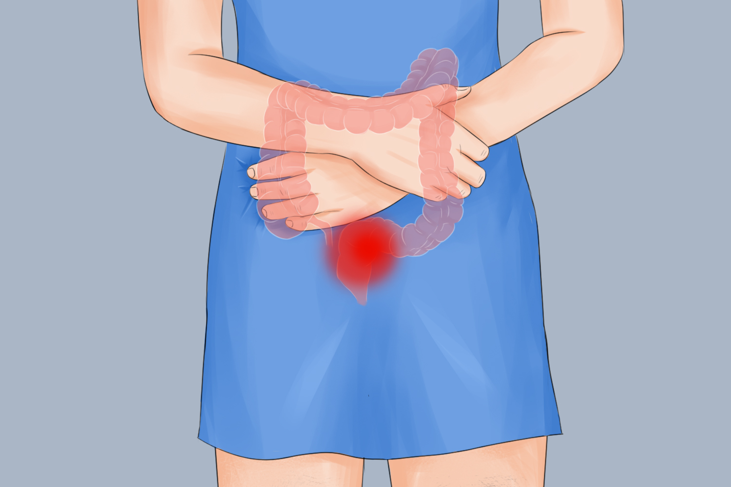 直肠癌下腹部疼痛图