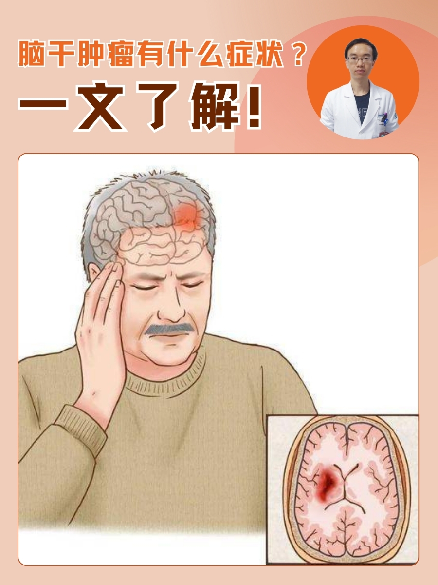 脑干肿瘤有什么症状?一文了解!