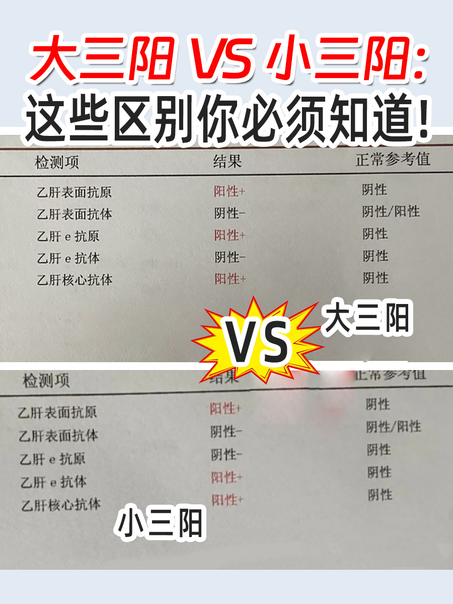 大三阳VS小三阳：这些区别你必须知道！