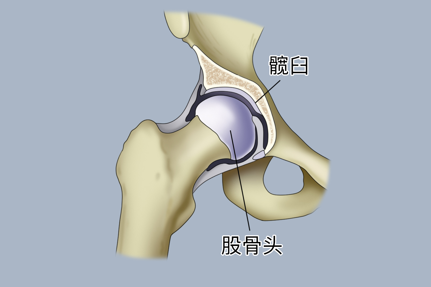 髋关节图 髋关节图