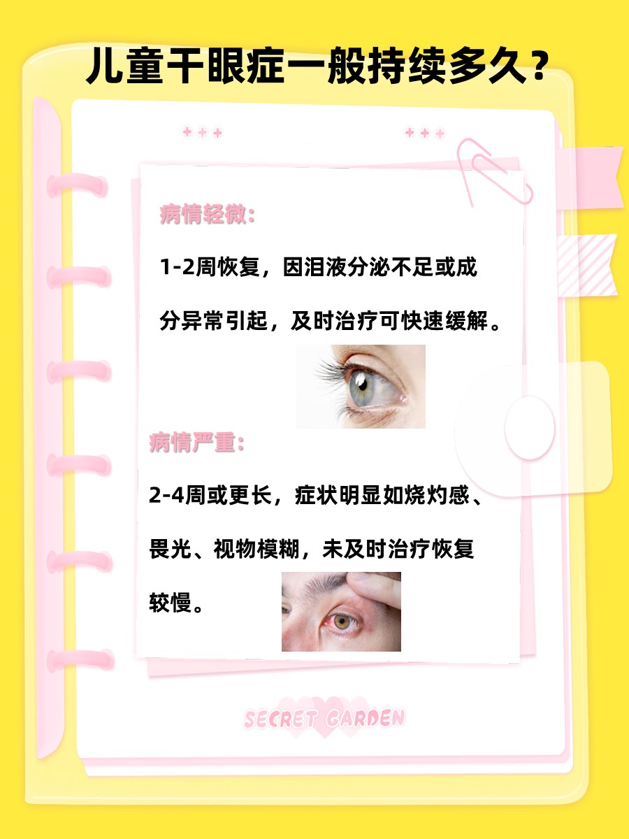 儿童干眼症：病程时长揭秘！