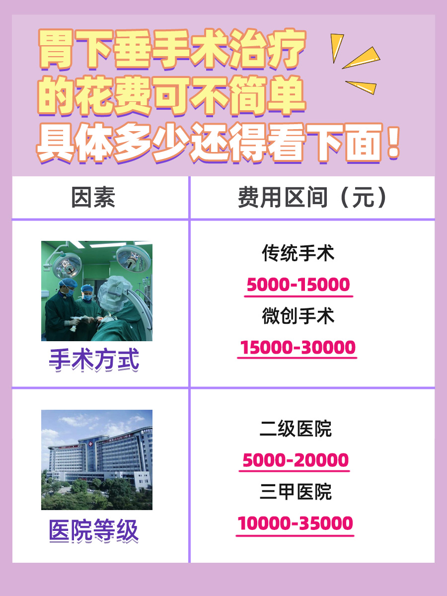 揭秘！胃下垂手术治疗的费用到底需要多少？