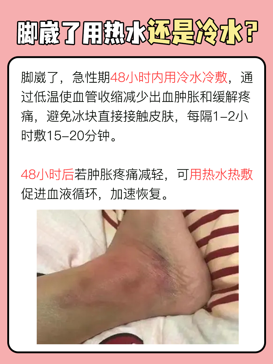 脚崴了用热水还是冷水?一文了解