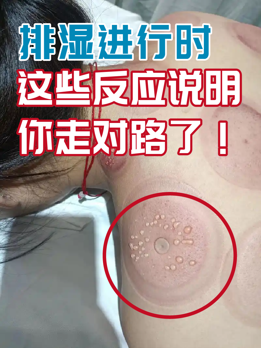 排湿进行时，这些反应说明你走对路了！