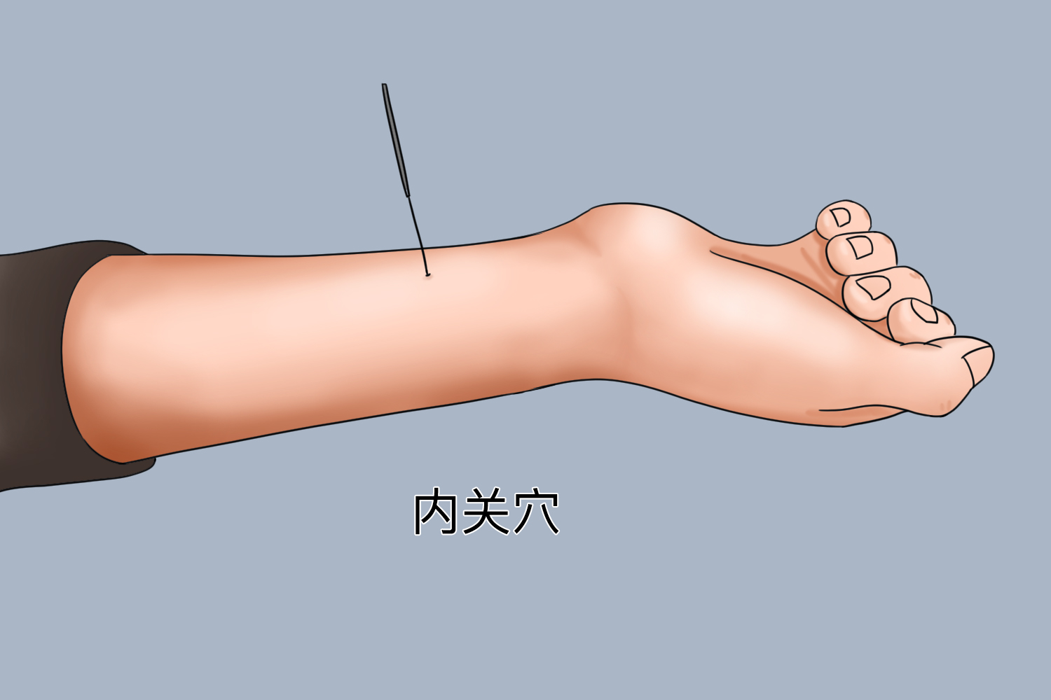 针灸内关穴图