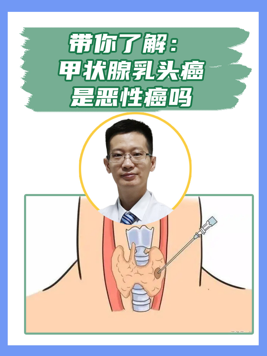 带你了解：甲状腺乳头癌是恶性癌吗