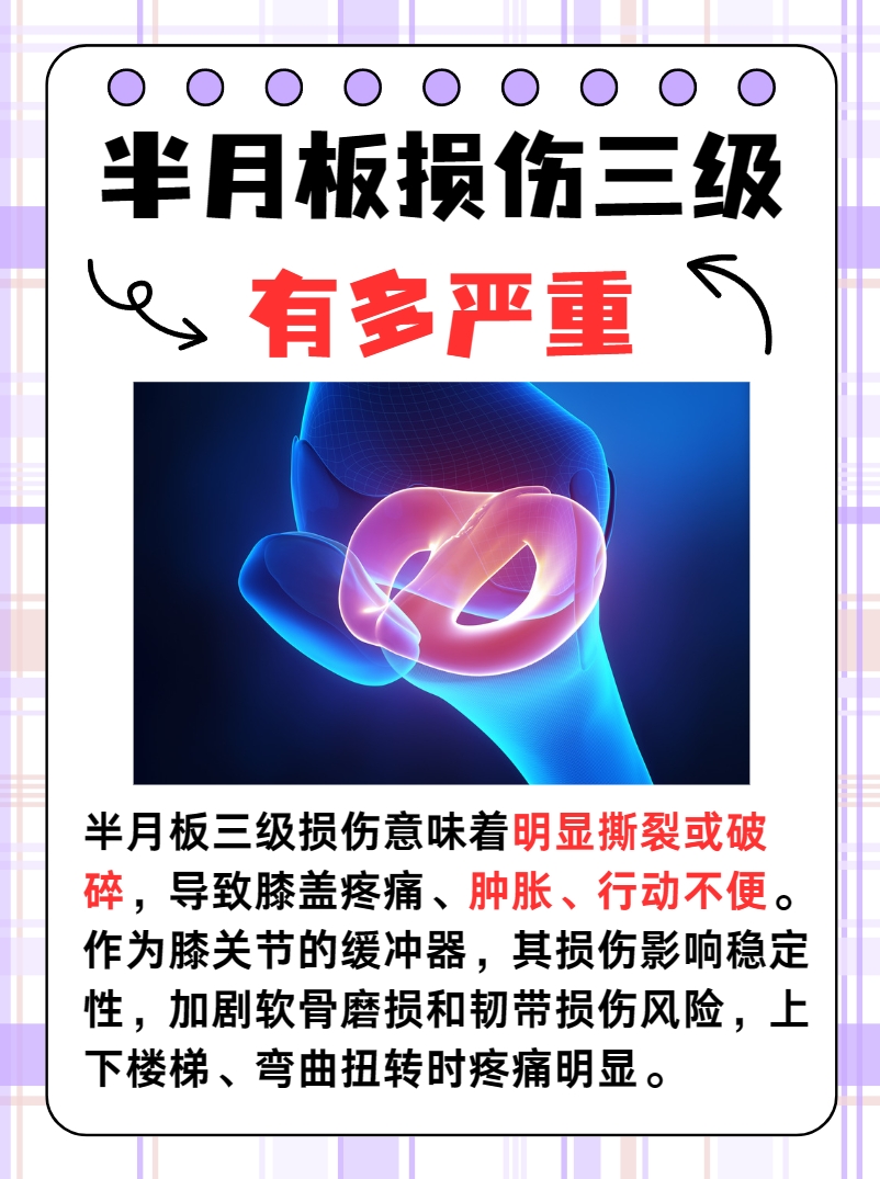 探究！半月板损伤三级有多严重