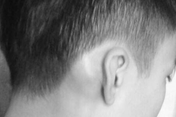 乳突骨突出正常图