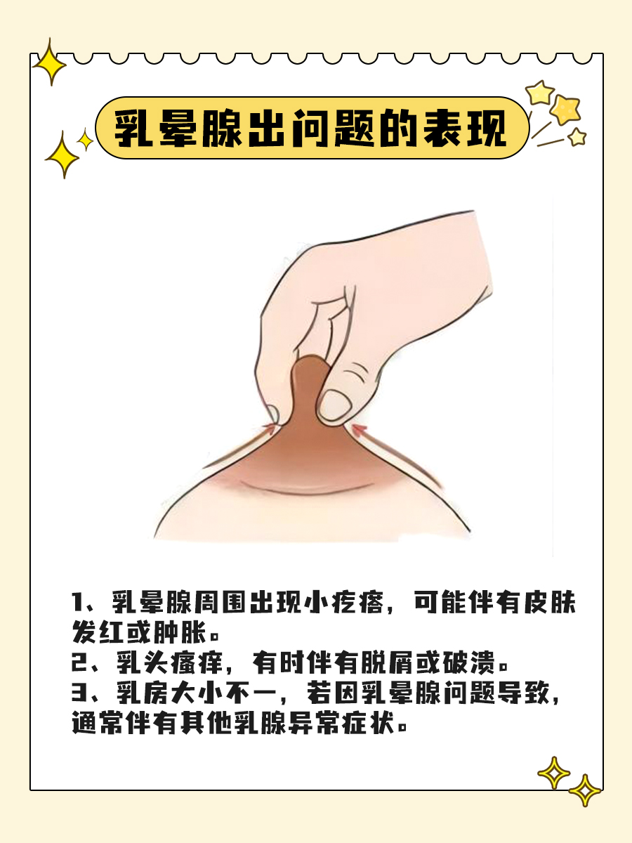 医学链接|乳晕腺是个啥？