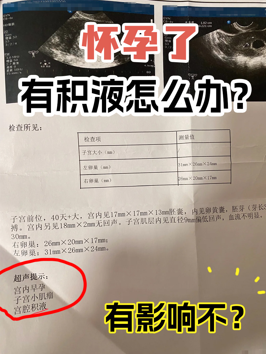 怀孕了有积液怎么办?有影响不?