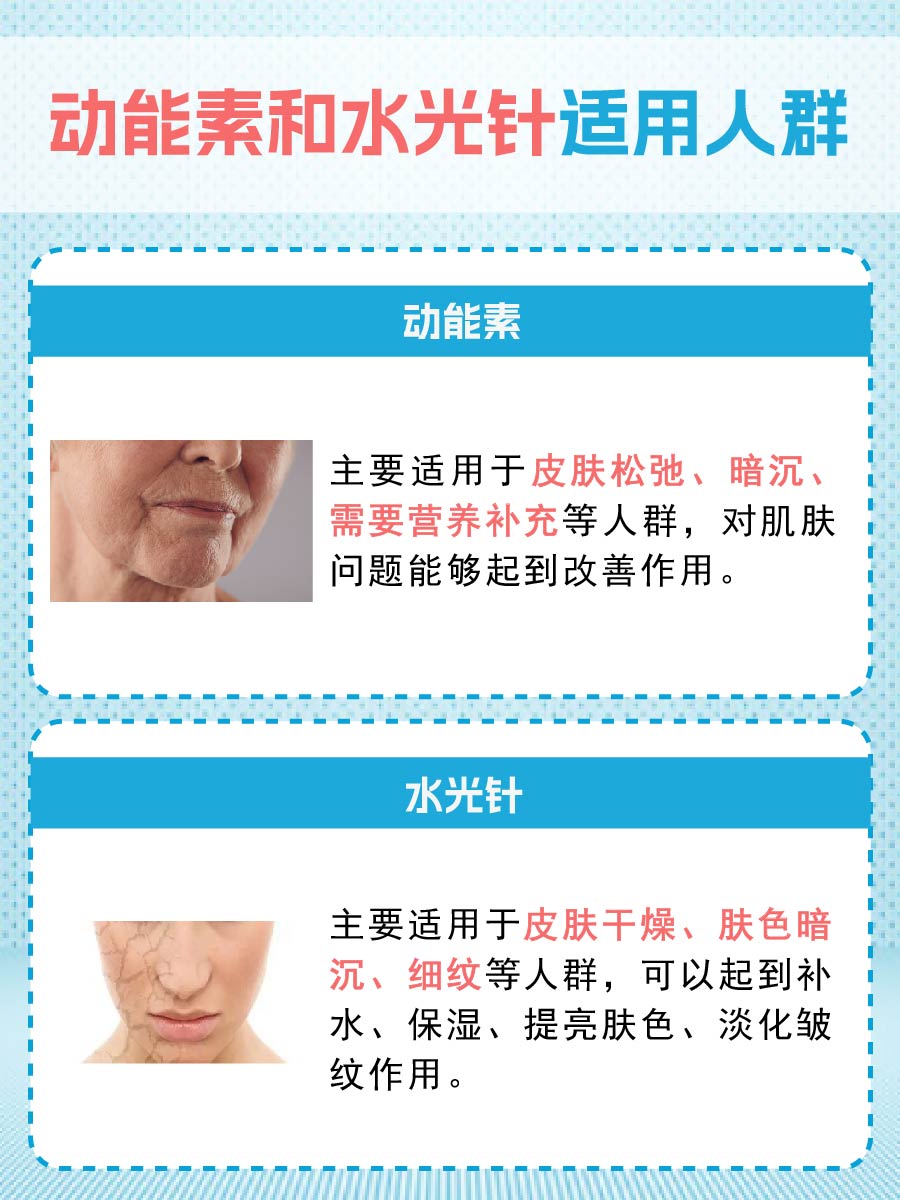 了解:动能素和水光针区别