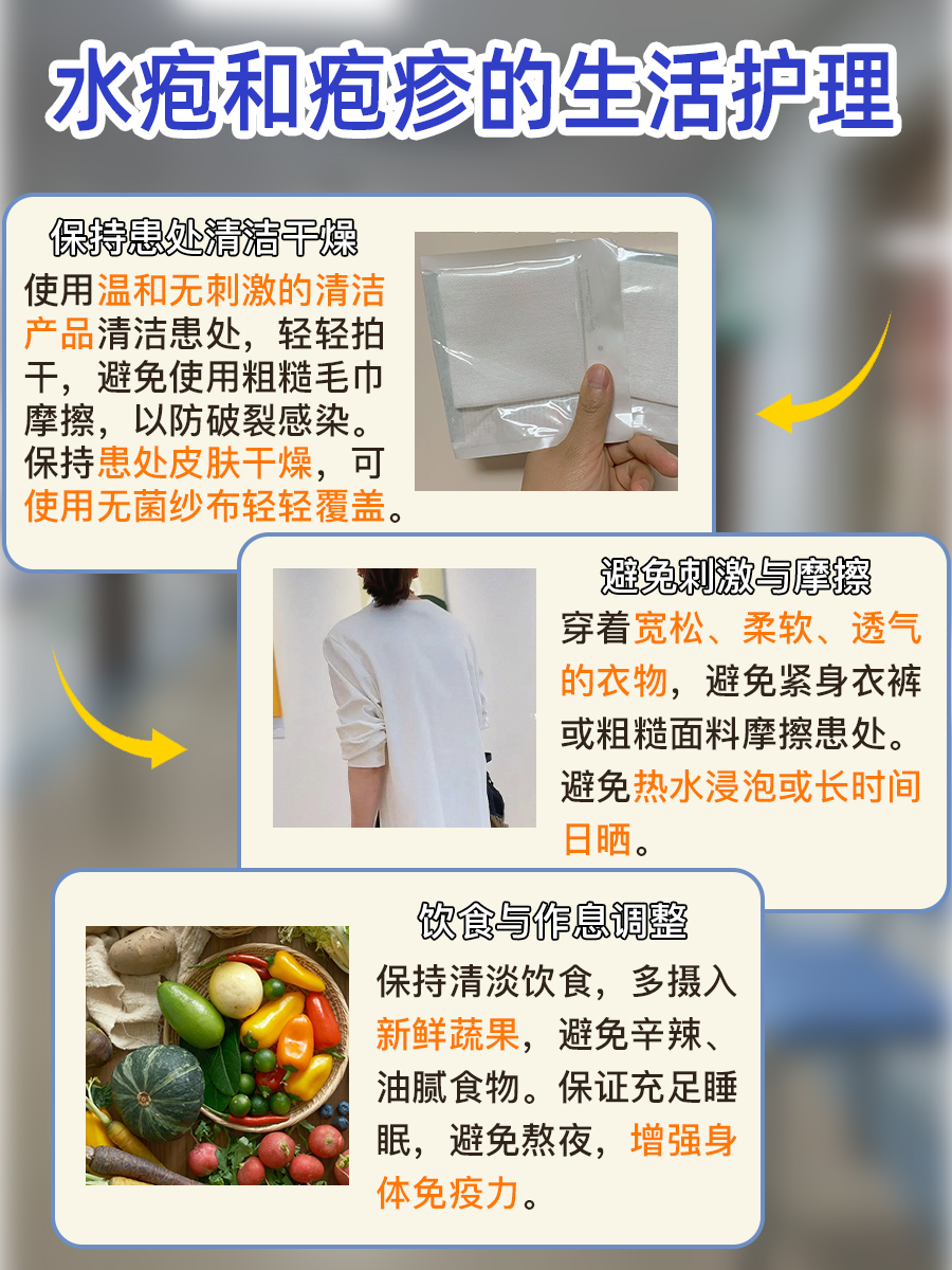 水疱还是疱疹?一文帮你分清两者区别!