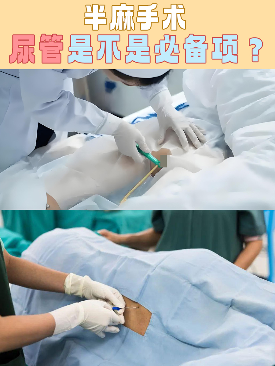 半麻手术，尿管是不是必备项？