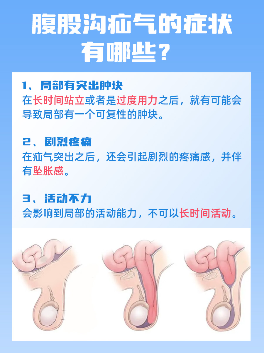 腹股沟疝气的症状,这些你都了解吗