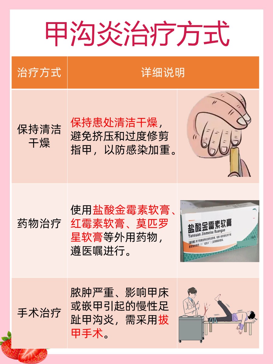 告别甲沟炎烦恼！医生建议V型剪法让指甲重生