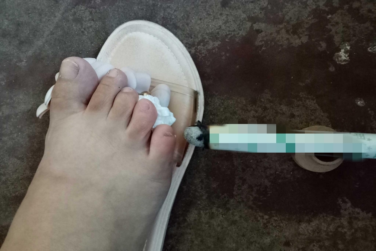 孕妇艾条熏脚正确方法图