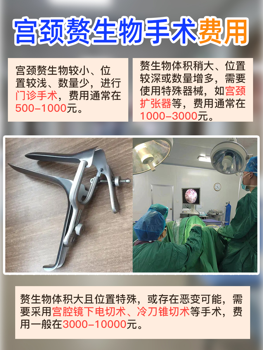 宫颈赘生物手术，费用知多少？