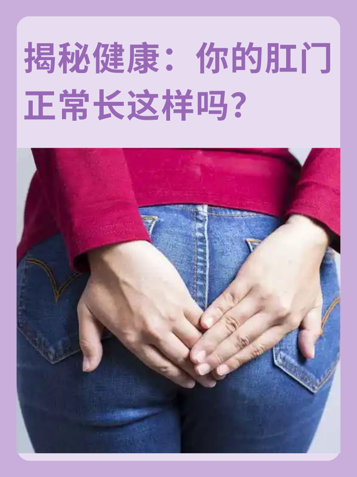 揭秘健康：你的肛门正常长这样吗？