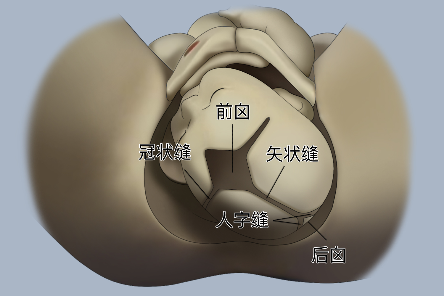 胎儿矢状缝图 胎儿矢状缝图