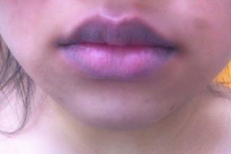 女人嘴唇发紫图