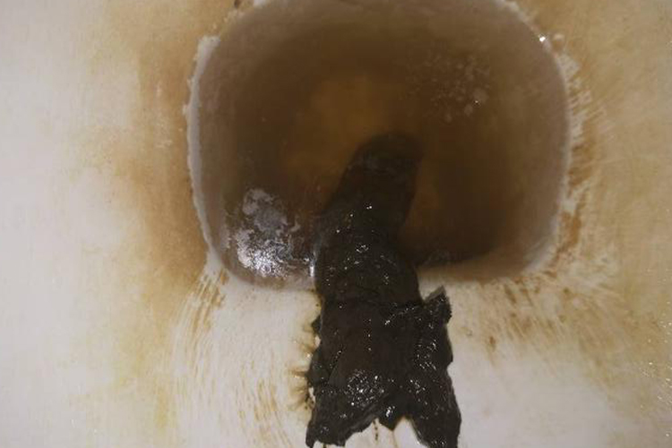 出血后在消化道停留时间的长短而表现出不同的颜色,如黑色(柏油样大便