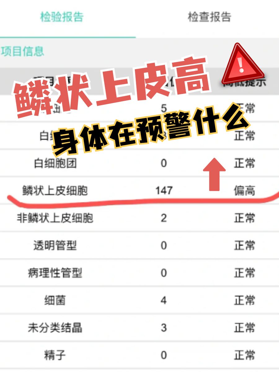 鳞状上皮高,身体在预警什么?
