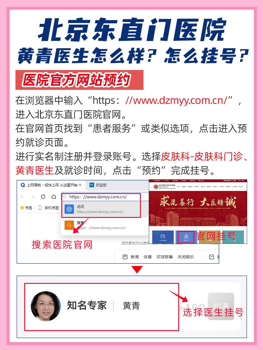 北京东直门医院黄青医生怎么样？怎么挂号？