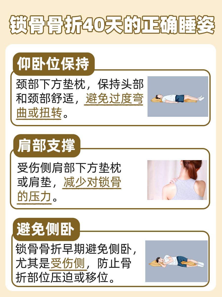 锁骨骨折40天正确睡姿图
