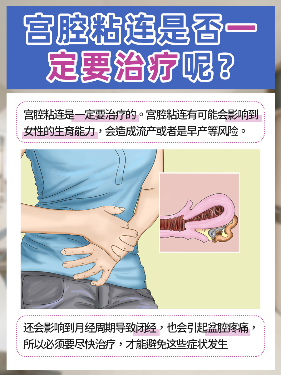 医生带你了解宫腔粘连！你一定需要治疗吗？