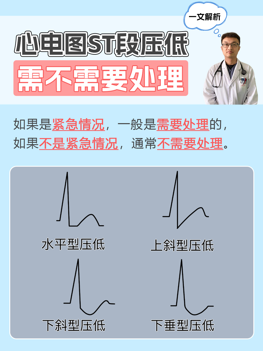 心电图ST段压低需不需要处理？一文解析