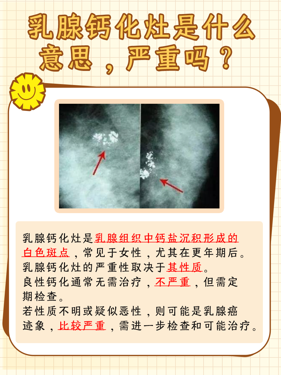 乳腺钙化灶意味着什么?严重性分析!