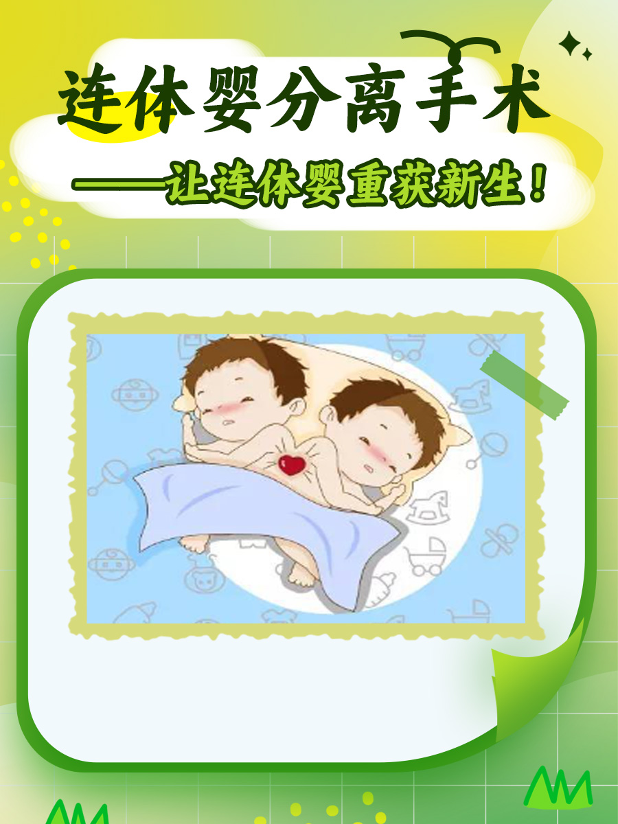 连体婴分离手术——让连体婴重获新生！