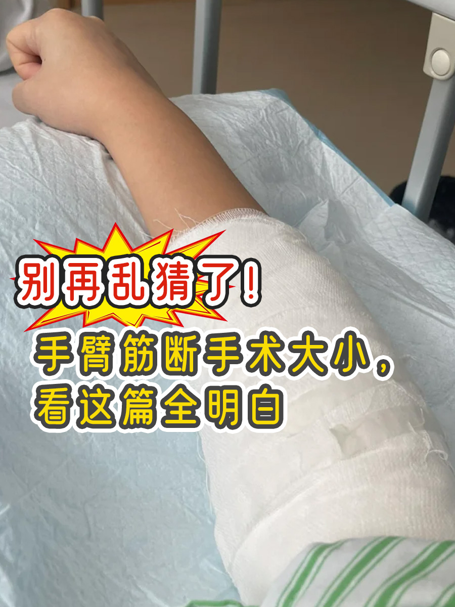 别再乱猜了！手臂筋断手术大小，看这篇全明白