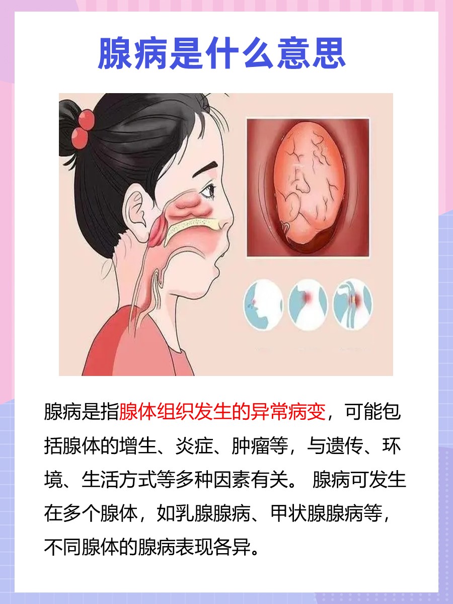 健康问答：腺病是什么意思