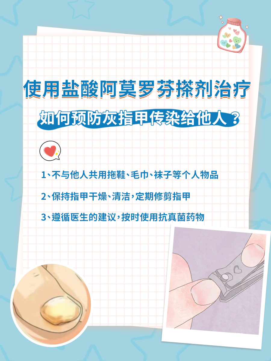 想知道盐酸阿莫罗芬搽剂价格？看这里就够了！