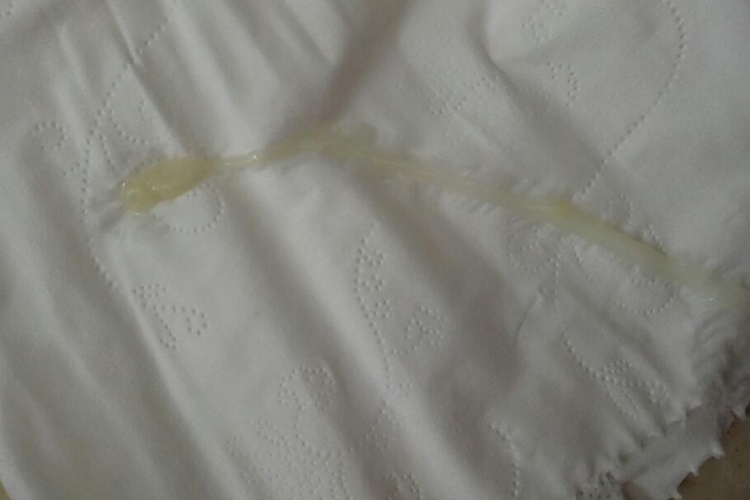 正常白带图 正常白带图